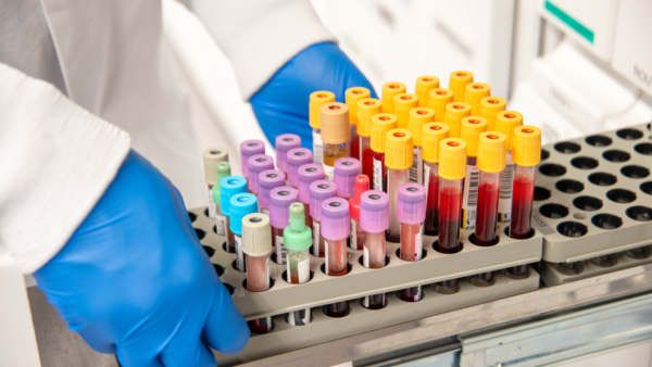 Fortbildung "Präanalytik